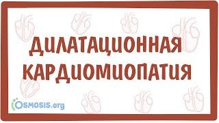 Дилатационная кардиомиопатия — причины, симптомы, патогенез, диагностика, лечение