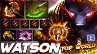 Watson Ursa - Top World Rank - Dota 2 Pro Gameplay [Watch & Learn]