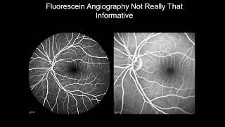 Preferred Imaging Modality for Identifying Laser-Pointer Eye Injuries in Children