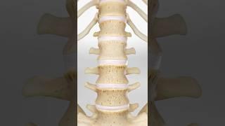 Understanding herniated disc pain (3D Animation)