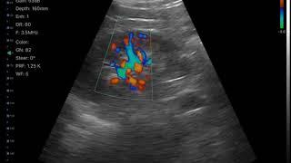 KONTED wireless convex+linear+cardiac ultrasound 3 in 1