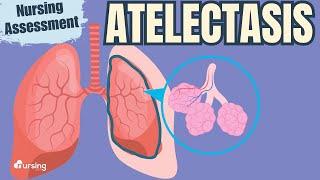 Atelectasis- Pathophysiology and Nursing Assessment