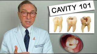 What Causes Tooth Decay? Cavity 101 | Causes | Treatment