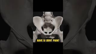 How To Fix SI Joint Pain!