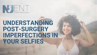 Understanding Post-Surgery Imperfections in Your Selfies | We Nose Noses