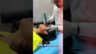 Dark Circle Removal Treatment | Dermapen Treatment #shorts  #aesthetic #beautytips