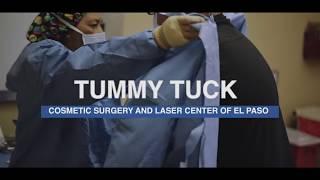 Tummy Tuck | El Paso Cosmetic Surgery
