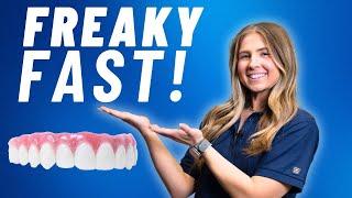 Can You Really Get Dental Implants in 24 Hours?!