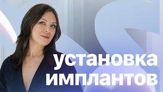 Установка имплантов | Сафонова Л.Н.