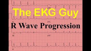 EKG/ECG R Wave Progression - Question 12.0 | The EKG Guy