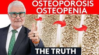 Dr. Gundry Reveals The Truth About Osteoporosis / Osteopenia Symptoms