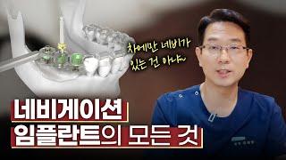 네비게이션 임플란트라면 무절개 임플란트가 가능하다⁉️| 장단점, 치료과정, 추천대상까지 다 알려드립니다