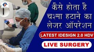 Most Advanced Technology for Specs Removal | HDV 2.0 IDesign Refractive Studio | Live Lasik surgery