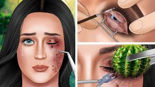 ASMR Help Katy Perry Remove cactus spines stuck in the eyes