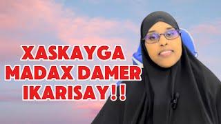 XASKAYGA MADAX DAMER IKARISAY!YABADANA @sawdamqaalib