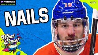 Zach Hyman is tough as nails, Nick Foligno & Taylor Hall join