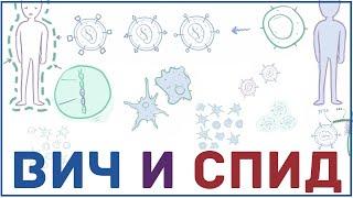 ВИЧ и СПИД - патогенез, причины признаки, симптомы, передача