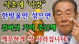 식초에 '이것' 한방울 섞으면 검버섯·기미·주근깨 2주만에 싹 없어집니다! 의사가 추천하는 진짜 효과 있는 검버섯·기미·주근깨 관리법｜노후사연｜인생이야기｜오디오북｜삶의 지혜