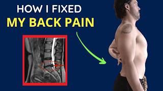 THIS Decision Healed My Back Pain without Surgery