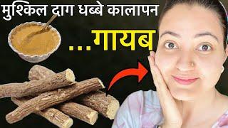 त्वचा की मुश्किल समस्या जैसे झाइयाँ HYPER PIGMENTATION, DARK SPOTS का 100% इलाज़ सिर्फ 1 हफ्ते में