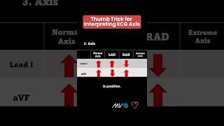 "Handy" Trick for Interpreting Axis on a 12-Lead ECG 