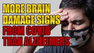 COVID-19 Brain Damage Worse Than Alzheimer's?