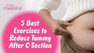 Top 5 Exercises to Reduce Stomach After C-Section | Postpartum Workout to Reduce Tummy