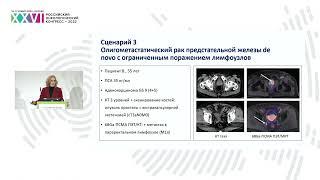 Особенности селекции пациентов для метастаз-направленной терапии при олигометастатическом РПЖ