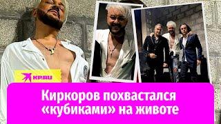 «Как у Давы»: Киркоров похвастался результатами пластики «внизу»