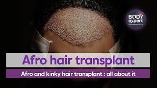 TURKEY HAIR TRANSPLANT | Afro and kinky hair transplant : all about it | BODYEXPERT