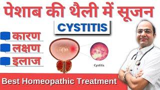 Cystitis | पेशाब की थैली में सूजन का कारण, लक्षण और होम्योपैथिक इलाज