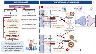 Fisiopatología- Enfermedad de Alzheimer