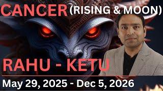 RAHU KETU Transit MAY 2025: What's in Store for CANCER Rising and MOON Sign?