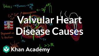 Valvular heart disease causes | Circulatory System and Disease | NCLEX-RN | Khan Academy