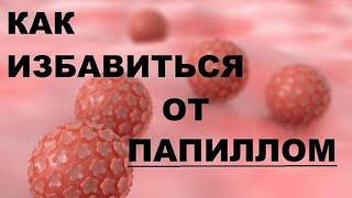 РЕЦЕПТ КВАСА ИЗ ЧИСТОТЕЛА ОТ ПАПИЛЛОМ.  Лекции по Паразитологии. Выпуск 52.