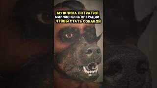 Пересадил себе лицо и шерсть от собаки #невероятныефакты #удивительное #реальныеистории
