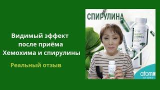 Хемохим и спирулина - артрит, рост волос, омоложение лица.