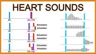 Heart Sounds (Murmurs and Splitting)