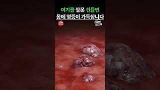 여기를 잘못 건들면 몸에 염증이 가득 찹니다 #건강정보 #건강