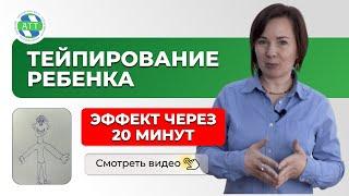 Тейпирование в логопедии  Опыт ученика Академии терапевтического тейпирования.