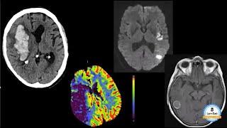 Lernrad Neuro(radiologie) Basics Kurs - Lust auf Fall-basiertes interaktives Lernen?