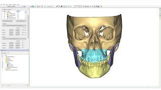 Orthognathics Part ll: Planning | PROPLAN CMF™