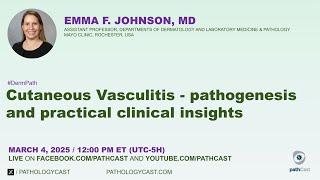 #DERMPATH Cutaneous Vasculitis - pathogenesis and practical clinical insights