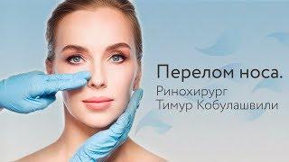 Перелом носа. Ринохирург Тимур Кобулашвили