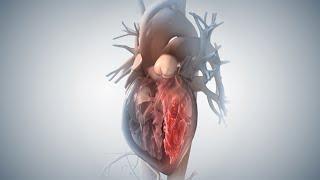 Acute Coronary Syndrome and Heart Attack