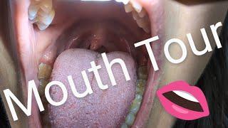 Mouth Tour Oral Examination