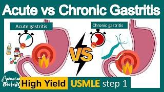 Acute vs chronic gastritis | pathology of gastritis | USMLE step 1