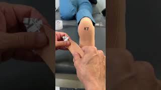 Plantar Fasciitis Treatment! WOW.
