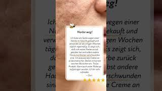 Narben mit Bienengift loswerden! #skincare #apitoxin #narben #mitesser #bienengift #naturkosmetik