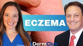 Best Ways to Treat Eczema | Atopic Dermatitis